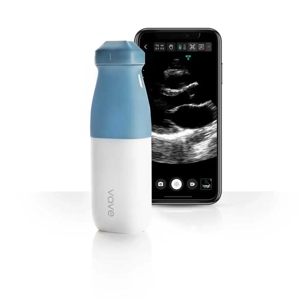 Vave - Ultrasound Untethered